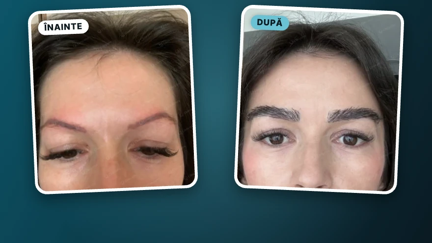 Laura · implant de sprâncene